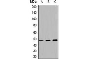Western blot analysis of MMP13 expression in DLD1 (A), rat lung (B), rat testis (C) whole cell lysates.