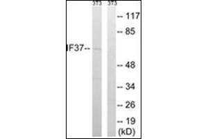 Western blot analysis of extracts from NIH-3T3 cells, using EIF3D Antibody. (EIF3D antibody)
