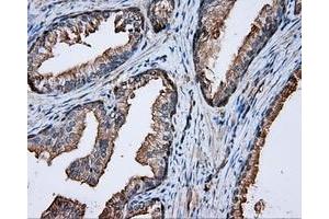 Immunohistochemical staining of paraffin-embedded prostate tissue using anti-PRKAR2A mouse monoclonal antibody. (PRKAR2A antibody)
