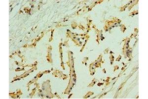 Immunohistochemistry of paraffin-embedded human prostate tissue using ABIN7161326 at dilution of 1:100 (Neuroligin Y antibody  (AA 682-816))