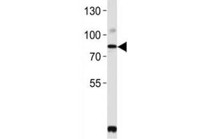 Western Blotting (WB) image for anti-Proprotein Convertase Subtilisin/kexin Type 9 (PCSK9) (AA 144-173) antibody (ABIN3032339)