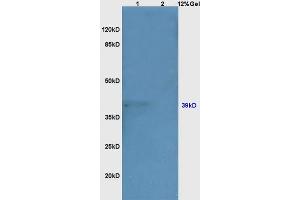 Lane 1: mouse kidney lysates Lane 2: mouse embryo lysates probed with Anti GRM1 Polyclonal Antibody, Unconjugated (ABIN687652) at 1:200 in 4 °C. (NEUROD1 antibody  (AA 21-120))