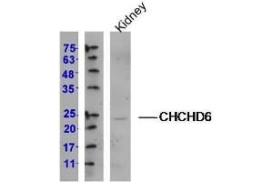 Lane 1: (mouse)Kidney lysates, probed with CHCHD6 Polyclonal Antibody, Unconjugated (Catalog # at 1:300 overnight at 4˚C. (CHCHD6 antibody  (AA 135-235))