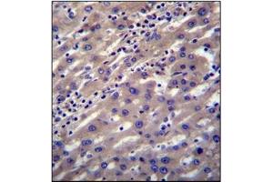 Immunohistochemistry analysis in Formalin Fixed, Paraffin Embedded Human liver tissue stained with SCP2 Antibody (N-term) followed by peroxidase conjugation of the secondary antibody and DAB staining. (SCP2 antibody  (N-Term))
