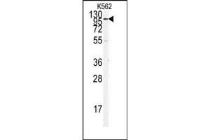 Image no. 1 for anti-Angiotensin I Converting Enzyme 2 (ACE2) (N-Term) antibody (ABIN358574) (ACE2 antibody  (N-Term))