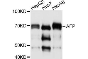 Western blot analysis of extracts of various cell lines, using AFP antibody (ABIN4902853). (alpha Fetoprotein antibody)