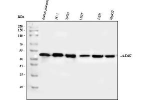 Western blot analysis of ADK using anti-ADK antibody (ABIN4886430). (ADK antibody  (AA 165-351))