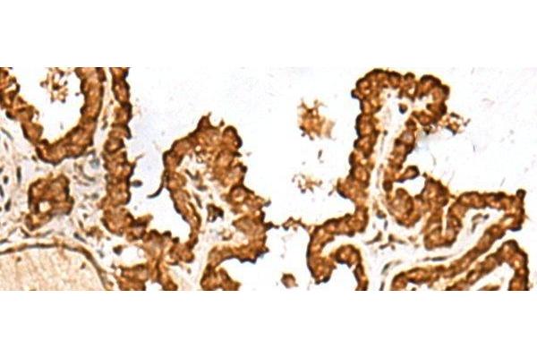 FAM200A antibody