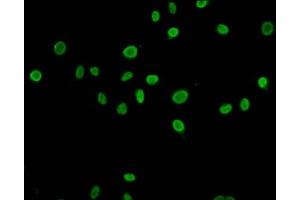 Immunofluorescence staining of Hela cells (treated with 30mM sodium butyrate for 4h) with ABIN7139198 at 1:5, counter-stained with DAPI. (HIST1H4A antibody  (acLys79))