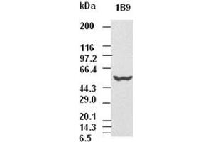 CK8 antibody (1B9) at 1:5000 dilution + Hela cell lysate (KRT8 antibody  (AA 91-381))
