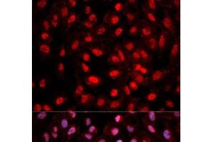 Immunofluorescence analysis of MCF-7 cells using Phospho-Dnmt1(pY399) Polyclonal Antibody (DNMT1 antibody  (pTyr399))