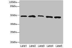 Western blot All lanes: PSMD13antibody at 3. (PSMD13 antibody  (Regulatory Subunit 13))