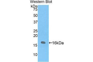 Western Blotting (WB) image for anti-Vasoactive Intestinal Peptide (Vip) (AA 34-157) antibody (ABIN1860940) (Vip antibody  (AA 34-157))