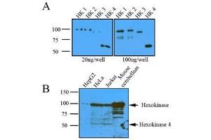 Western Blotting (WB) image for anti-Hexokinase 1 (HK1) (AA 1-917), (N-Term) antibody (ABIN317095) (Hexokinase 1 antibody  (N-Term))