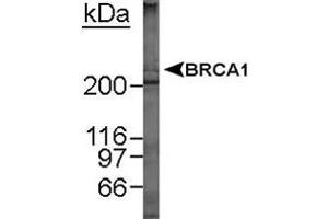 Western blot analysis of BRCA1 in MCF-7 whole cell lysate using BRCA1 monoclonal antibody, clone MU . (BRCA1 antibody  (AA 1314-1864))