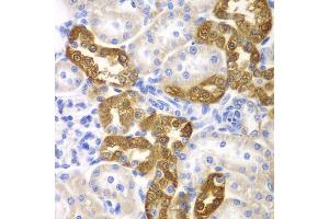 Immunohistochemistry (IHC) image for anti-CD151 (CD151) (AA 113-221) antibody (ABIN3023661)