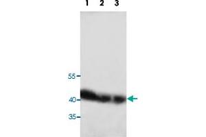 Western blot analysis of mouse liver (Lane 1), Jurkat (Lane 2) and human fetal intestine lysate (Lane 3) with ACAT2 polyclonal antibody  at 1:500 dilution. (ACAT2 antibody)