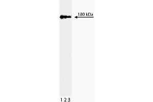 Western blot analysis of Topo IIbeta on a Jurkat lysate. (TOP2B antibody  (AA 1281-1494))