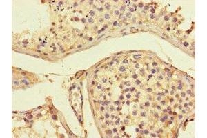 Immunohistochemistry of paraffin-embedded human testis tissue using ABIN7143303 at dilution of 1:100 (Adenosine A2a Receptor antibody  (AA 291-412))