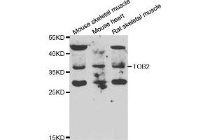 Western blot analysis of extracts of various cell lines, using TOB2 antibody.