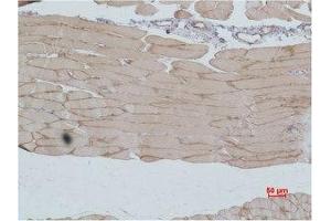 Immunohistochemical analysis of paraffin-embedded Mouse Skeletal MuscleTissue using IGFN1 Polyclonal Antibody. (IGFN1 antibody)