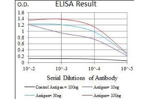 Black line: Control Antigen (100 ng), Purple line: Antigen(10 ng), Blue line: Antigen (50 ng), Red line: Antigen (100 ng), (DNAL4 antibody  (AA 1-105))