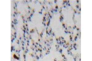 Used in DAB staining on fromalin fixed paraffin-embedded Lung tissue (CCL2 antibody  (AA 1-99))