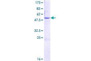 THAP Domain Containing 6 (THAP6) (AA 1-222) protein (GST tag)