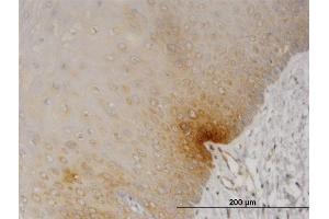 Immunoperoxidase of monoclonal antibody to DYRK2 on formalin-fixed paraffin-embedded human esophagus. (DYRK2 antibody  (AA 1-100))