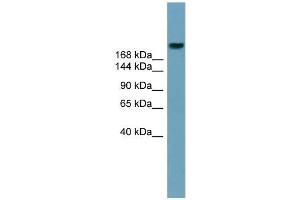 Human Stomach; WB Suggested Anti-ABCA12 Antibody Titration: 0.