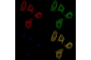 ABIN6259561 and ABIN6274852 staining Hela cells by IF/ICC. (C1orf135 antibody  (Internal Region))
