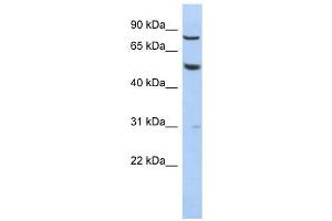 GPR56 antibody used at 1 ug/ml to detect target protein. (GPR56 antibody  (N-Term))