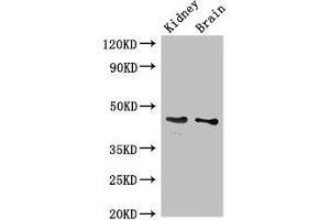 Western Blot Positive WB detected in: Mouse kidney tissue, Mouse brain tissue All lanes: GDF11 antibody at 3 μg/mL Secondary Goat polyclonal to rabbit IgG at 1/50000 dilution Predicted band size: 46 kDa Observed band size: 46 kDa