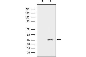 anti-C-Type Lectin Domain Family 6, Member A (CLEC6A) (Internal Region) antibody