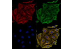 ABIN6264024 and ABIN6279643 staining Hela cells by IF/ICC. (PALLD antibody  (Internal Region))