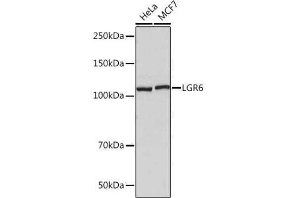 LGR6 antibody