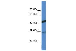 WB Suggested Anti-Dgat2 Antibody Titration: 1. (DGAT2 antibody  (C-Term))