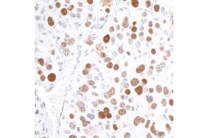 Immunohistochemistry (IHC) image for anti-Importin Subunit alpha-1 (KPNA2) (C-Term) antibody (ABIN7453571) (Importin Subunit alpha-1 (KPNA2) (C-Term) antibody)