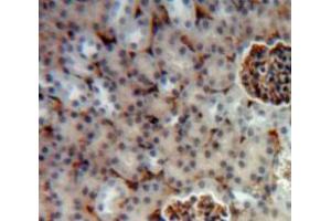 Used in DAB staining on fromalin fixed paraffin-embedded Kidney tissue (Hexosaminidase A antibody  (AA 318-529))