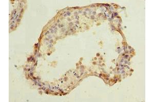 Immunohistochemistry of paraffin-embedded human testis tissue using ABIN7148124 at dilution of 1:100 (CCDC42 antibody  (AA 1-242))