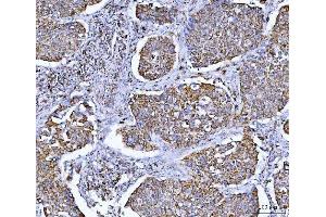 IHC analysis of GLUD1/2 using anti-GLUD1/2 antibody (ABIN7602000). (GLUD1 / GLUD2 (AA 54-553) antibody)