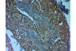IHC on paraffin sections of rat DRG using Rabbit antibody to TrkC . (NTRK3 antibody)
