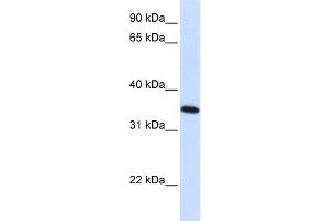 WB Suggested Anti-RTN1 Antibody Titration:  0.