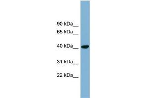 WB Suggested Anti-PINX1 Antibody Titration: 0. (PINX1 antibody  (N-Term))