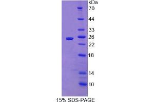 Image no. 1 for Interleukin 1 Receptor Accessory Protein-Like 1 (IL1RAPL1) (AA 113-276) protein (His tag) (ABIN6238380)