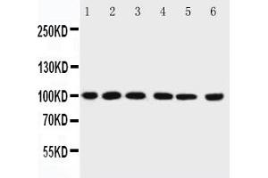 Image no. 1 for anti-Protein Inhibitor of Activated STAT, 1 (PIAS1) (AA 636-651) antibody (ABIN3032369) (PIAS1 antibody  (AA 636-651))