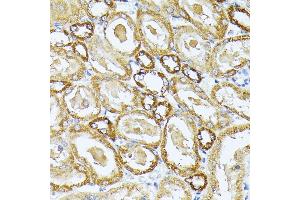 Immunohistochemistry of paraffin-embedded rat kidney using MT-CO3 antibody (ABIN7266636) at dilution of 1:100 (40x lens).