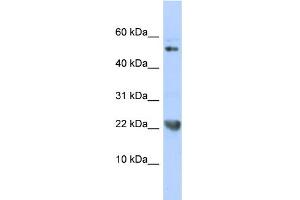 WB Suggested Anti-TNFSF12 Antibody Titration:  0. (TWEAK antibody  (N-Term))