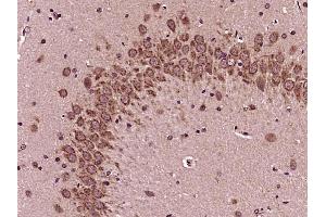 Paraformaldehyde-fixed, paraffin embedded rat brain, Antigen retrieval by boiling in sodium citrate buffer (pH6) for 15min, Block endogenous peroxidase by 3% hydrogen peroxide for 30 minutes, Blocking buffer (normal goat serum) at 37°C for 20min, Antibody incubation with Bad (Ser118) Polyclonal Antibody, Unconjugated  at 1:200 overnight at 4°C, followed by a conjugated secondary and DAB staining. (BAD antibody  (pSer118))