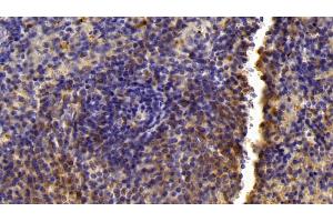Detection of LXRb in Mouse Spleen Tissue using Polyclonal Antibody to Liver X Receptor Beta (LXRb)